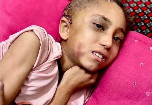 ‎6.8.25‏ העיר עזה: מייס עבד אלעל, בת 10